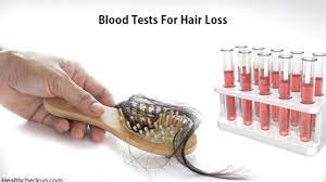 Repeat treatments may be necessary to maintain the improvement in hair growth and texture. Types Blood Tests For Hair Loss Hair Loss Due To Stress Will It Grow Back