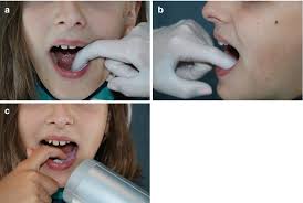 Intraoral Radiography in Dentistry