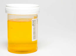 Urine Smells Like Sulfur 11 Causes And Treatment