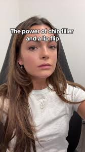 #chinfiller #chinfillerbeforeandafter #botox #filler #lipflip  #lipflipresults #esthetics