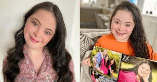 Check spelling or type a new query. Meet Ellie Goldstein The Model With Down Syndrome Who Stars In Gucci Beauty S New Campaign
