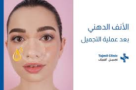 الأنف الدهني بعد عملية التجميل | الأسباب والعلاج