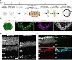 Whether it's for function or style, hair clips are a helpful accessory for everyday use. Transplantation Of Photoreceptors Into The Degenerative Retina Current State And Future Perspectives Sciencedirect