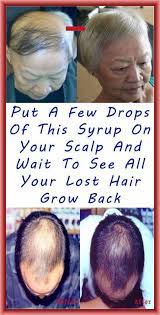 Put A Few Drops Of This Syrup On Your Scalp And Wait To See All Your Lost Hair Grow Back Health Promotion Grow Hair Lost Hair Hair Loss Remedies