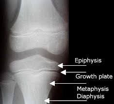 Image result for Knee XRay