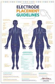 Electrode Placement Guidelines Tens Electrode Chart Medi Stim Inc Tens Unit Placement Tens Electrode Placement Tens Electrodes