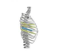 Marathon Instrument Set,Medical Device & Implants ...
