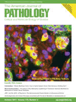 Phosphatase and Tensin Homolog