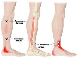 Pin On Yoga Anatomy