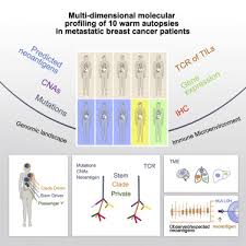 Metastatic breast cancer occurs when cancer that started in the breast spreads to another part of the body. The Genomic And Immune Landscapes Of Lethal Metastatic Breast Cancer Sciencedirect