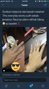 Mungkin tangan anda sering mengalami panas akibat cabe karena anda memang menyukai makanan pedas dan rasanya tangan akan begitu pedas menyengat. Ini Caranya Nak Dapatkan Kulit Flawless Dengan Hanya Menggunakan Produk Skincare Dari Watson The Reporter