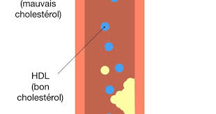 Ldl Et Hdl Cholesterol Bon Cholesterol Taux De Cholesterol