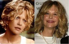For zellweger and ryan, criticism rests on the sense that cosmetic surgery has destroyed the unique features and charm that were key to their . Celebs Who Ruined Their Career With Plastic Surgery Circulating Now