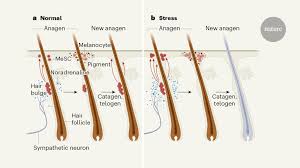 If there is stress, there will be depletion of stem cells in hair follicles. How The Stress Of Fight Or Flight Turns Hair White