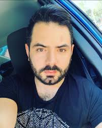 José Eduardo Derbez confesó que sufre de alopecia: sí se sometería a un  injerto de cabello