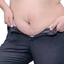 8 kebiasaan buruk penyebab perut buncit. Tips Hilangkan Perut Buncit Posts Facebook