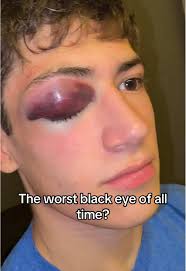 Tennis Doubles Partners: A Fun Side Switch Moment