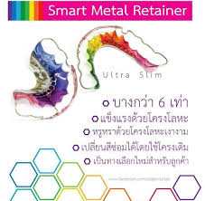 smart metal retainer ราคา c