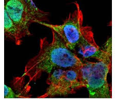 Igg elisa kit allows for the in vitro quantitative determination of igg concentrations in plasma, tissue homogenates and other biological fluids. Vdac1 Antibody Mybiosource