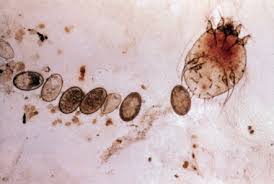 Image result for Sarcoptes scabiei life cycle
