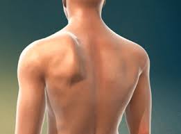 Image result for Winged Scapula