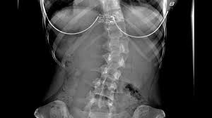 Original poster 1 point · 1 year ago. Hurricane Incoming Lightkeeper Promotions