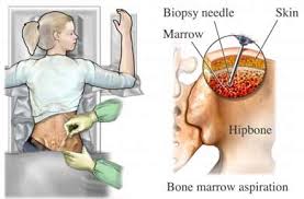 It is composed of hematopoietic cells, marrow adipose tissue, and supportive stromal cells. Blood Cancer Awareness Post 7 Bone Marrow The Life Of A Vaguely Neurotic Mpn Patient