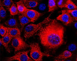For pancreatic cancer, a multiphase ct scan or a pancreatic protocol ct scan can help visualize the tumor. Pancreatic Cancer Drug Resistance Mechanisms Uncovered