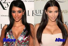 This story originally appeared on people.com. Kim Kardashian Before And After Cosmetic Procedure Photoshoptutorialsurreal Kim Kardashian Before Kardashian Plastic Surgery Kim Kardashian Surgery