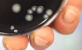 Legionellen Gefunden Schwimmhalle In Aachen Brand Muss Wieder Geschlossen Werden