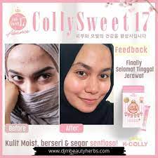Abg ash sendri dah tgk dpn2 mate!! K Colly Kcolly Colly Sweet17 Nano Advance New Look Formula