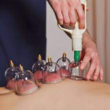 Amazon.com: Moclever 32 Cups Cupping Set with Pump, Chinese Massage Therapy  Cupping Set Body Vacuum Suction Kit Acupoint Massage Kit : Health &  Household