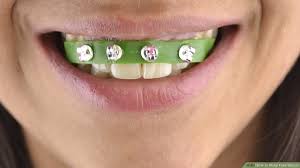 Diy direct offers you the trade's secret: How To Make Fake Braces 11 Steps With Pictures Wikihow