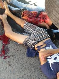IMAGENS FORTES! HOMEM E MULHER SÃO ATROPLEADOS POR CARRETA E FICAM  GRAVEMENTE FERIDOS. VEJA VÍDEO