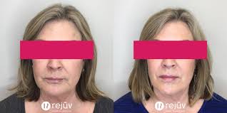 Rejuv Medical Aesthetic Clinic