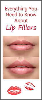 Lip Filler Before And After In 2020 Lip Fillers Lip Implants Lip Injections