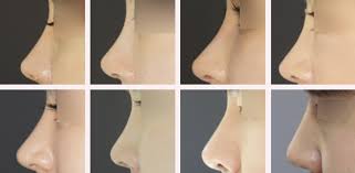Korea's first and only plastic surgery clinic designated as a good medical institution to attract foreign patients by the korean government. Answer Plastic Surgery Korea The Best Plastic Surgery Clinic In Korea