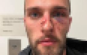 Gay man 'beaten by bouncers' at popular LGBTQ+ nightclub in Manchester