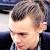 Thinning Hair Long Hair Receding Hairline