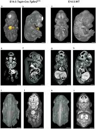Cel mai tare serial de comedie creat vreodata la noi in tara. Abrogation Of Tgf Beta Signalling In Tagln Expressing Cells Recapitulates Pentalogy Of Cantrell In The Mouse Scientific Reports