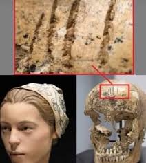 Herodotus mentions funerary cannibalism among the Callatiae, a tribe of  India. Also, the Aghoris of northern India consume the flesh of the dead  floated in the Ganges in pursuit of immortality and