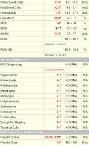 Image result for Plasmic Score