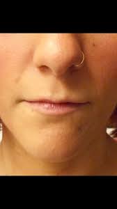 RealSelf: Daniel Belkin, MD