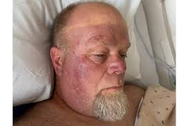 Fundraiser for Cynthia Fairman by Johnathyn Fairman Fairman : Donate to  Jeff Fairman's Recovery Fund