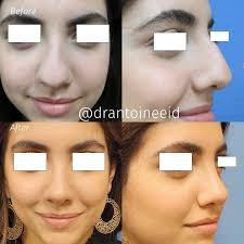 Dr. Antoine Eid MD, PhD (@drantoineeid) · Beirut