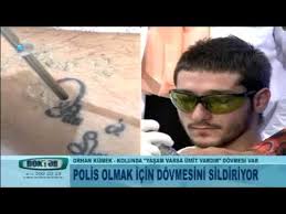 Vucuttaki Dovmeler Nasil Siliniyor Youtube