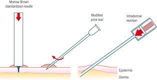 Skin Tests An Overview Sciencedirect Topics