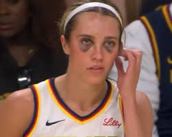 I didn't take notice who it was that was batting but he looked like Will  Clark with that eye black￼. Lol