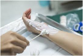 What To Do After Experiencing A Burn Wound Advanced Tissue