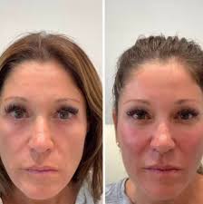 Love my Sedo Team and all of our beautiful Barbies today! So much fun,  blessed by this group for sure! #sedosisters #sedolaser #sedo #barbie  #dfwmedspa #botox #juvederm #halloween